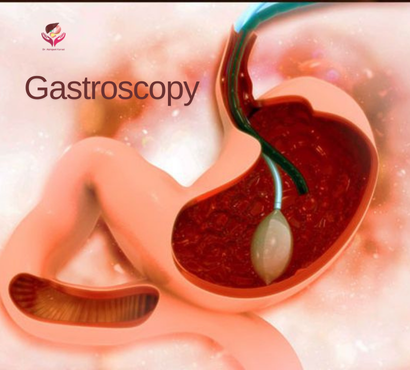 Gastroscopy Explained: What It Is and How It Helps